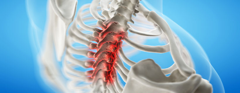 patient needing spinal stenosis in need of spinal decompression therapy in Monroeville