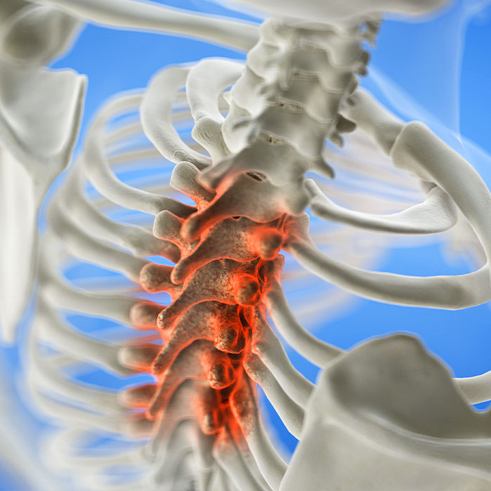 spinal Stenosis treatment in Monroeville